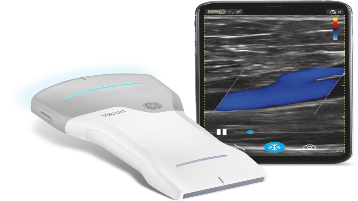 GE Healthcare Makes Entry Into Handheld Ultrasound Device Ring
