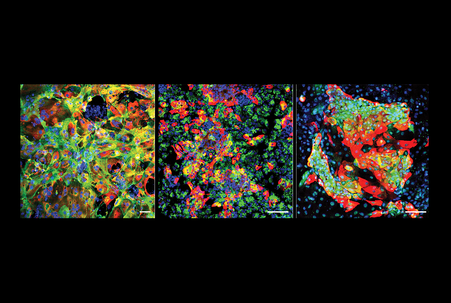 Study Identifies Human Genes Enabling SARS-CoV-2 Infection