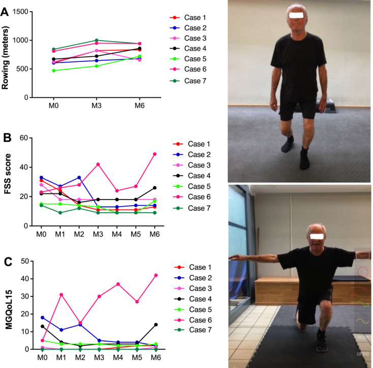 Implementation of tailored exercise programs for MG patients in a gym setting: a pragmatic feasibility case study