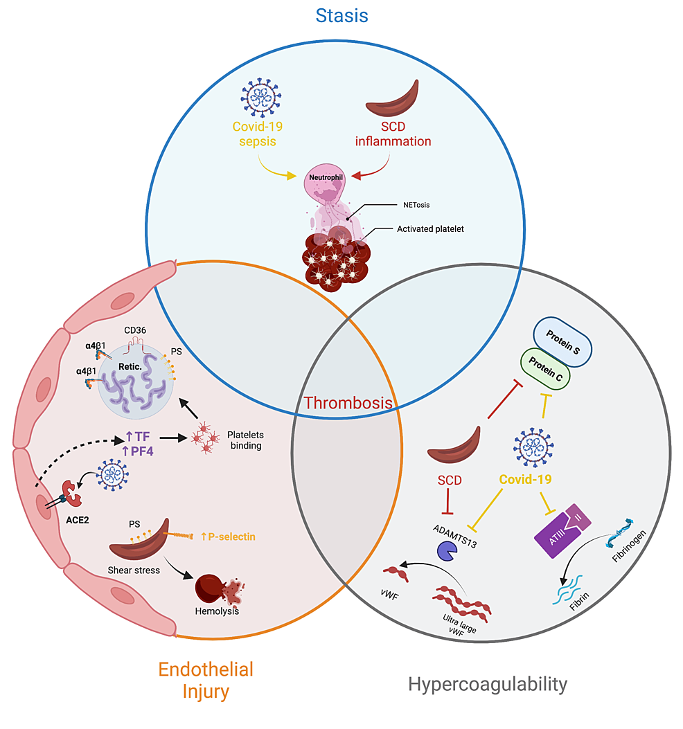 COVID-19 and Sickle Cell Disease: Two Independent Risk Factors for Venous Thromboembolism