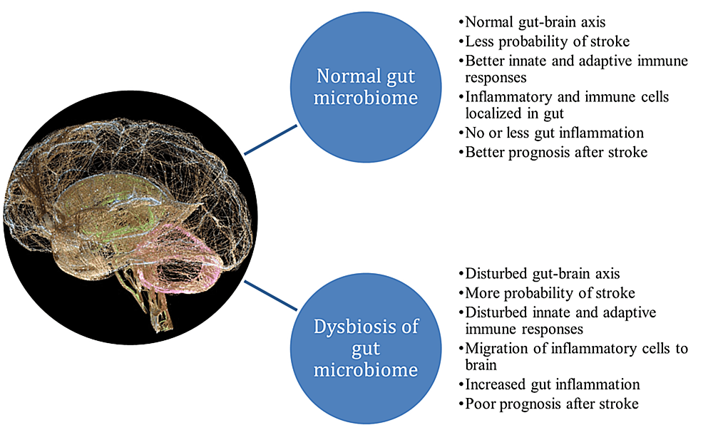 Connecting the Dots: The Interplay Between Stroke and the Gut-Brain Axis