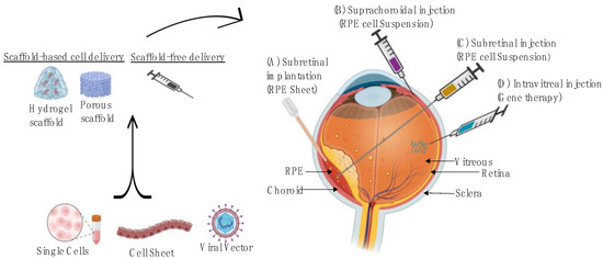 Advanced Therapy Medicinal Products for Age-Related Macular Degeneration; Scaffold Fabrication and Delivery Methods