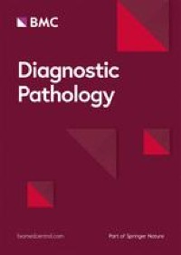 Non-hyalinizing trabecular thyroid adenoma: a novel thyroid tumor with diagnostic pitfalls of hyalinizing trabecular adenoma and medullary thyroid carcinoma - Diagnostic Pathology