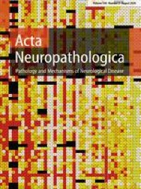 Individual myasthenia gravis autoantibody clones can efficiently mediate multiple mechanisms of pathology - Acta Neuropathologica