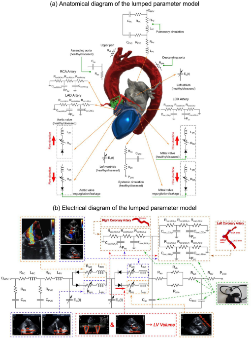 Impact of TAVR on coronary artery hemodynamics using clinical measurements and image‐based patient‐specific in silico modeling - Scientific Reports