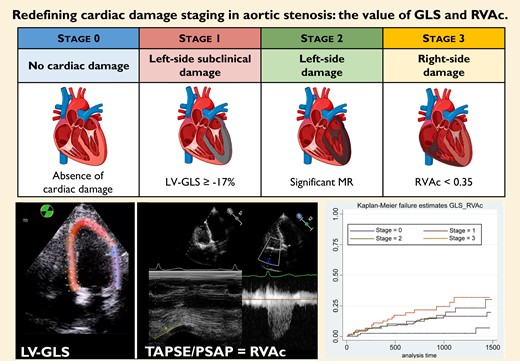 Redefining cardiac damage staging in aortic stenosis: the value of GLS and RVAc*