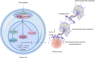 Fucoxanthin inhibits gastric cancer lymphangiogenesis and metastasis by regulating Ran expression